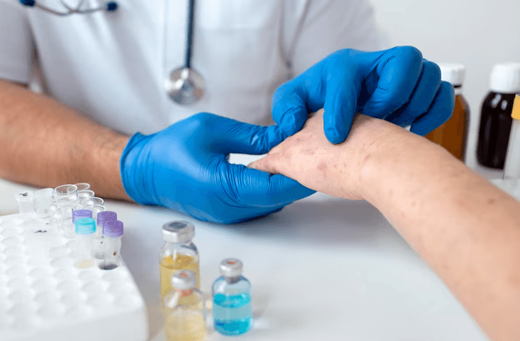 Pastikan Zero Cacar Monyet, Dinkes Palembang Imbau Hindari Sentuhan Fisik