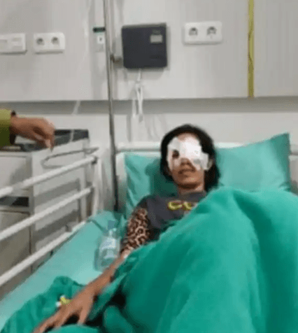 Bola Mata IRT di Palembang Ditusuk Suami Siri Pakai Cutter