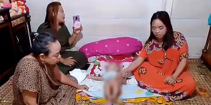 Bayi 10 Bulan di Palembang Alami Penyakit Langka Kelamin Ganda, Orang Tua Harapkan Bantuan Pemerintah
