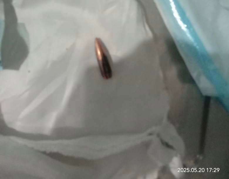 Peluru Nyasar Hantam Kaki Kernet di Palembang, Polisi Selidiki Asal Tembakan