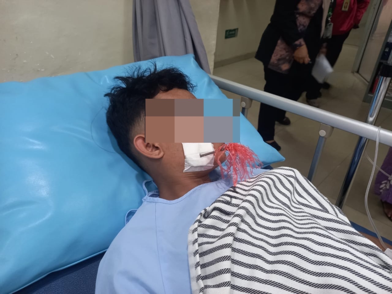 Salah Sasaran Tawuran, Pemuda di Palembang Tertancap Anak Panah di Pipi