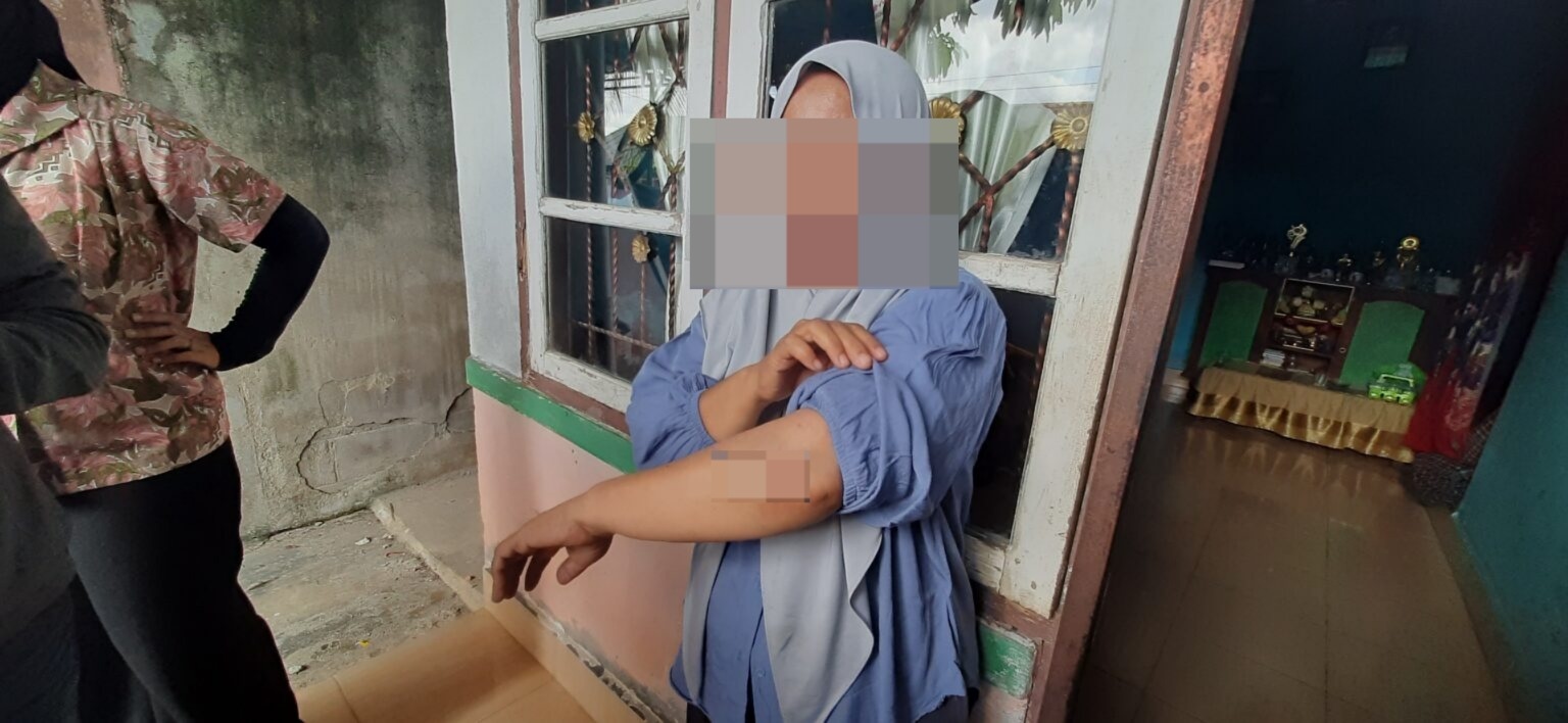 Korban Begal di Palembang Masih Trauma, Luka dan Motor Jadi Saksi Aksi Brutal Dua Pelaku Bersenjata Tajam